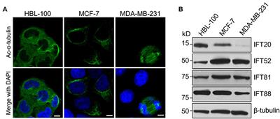 IFT20 Mediates the Transport of Cell Migration Regulators From the Trans-Golgi Network to the Plasma Membrane in Breast Cancer Cells